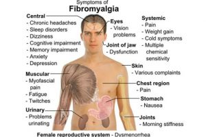 fibromyalgia2