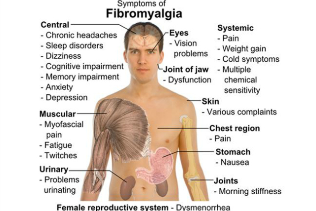 What is Really Known about the Cause Of Fibromyalgia? Chiropractors in Southampton at The Avenue Clinic Discuss.   